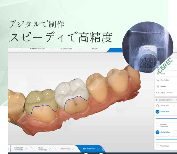 スピーディで高精度